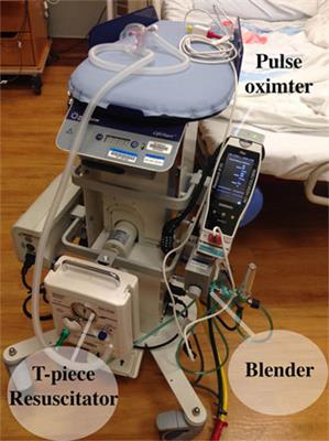 Providing a Placental Transfusion in Newborns Who Need Resuscitation